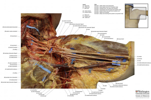 Potential for nerve injury in the collar bone area?